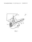 FILTER APPARATUSES AND METHODS OF USING SAME diagram and image