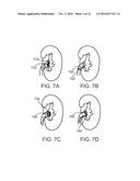 FILTER APPARATUSES AND METHODS OF USING SAME diagram and image