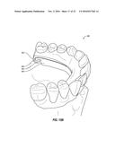 DENTAL DEVICES AND RELATED TECHNOLOGY diagram and image