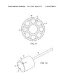 NEUROSTIMULATION LEAD WITH STIFFENED PROXIMAL ARRAY diagram and image