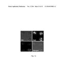 POLYPEPTIDES TARGETING GLYCOSYLATED MUC2 PROTEINS, METHODS OF SYNTHESIS,     THEIR NUCLEIC ACIDS AND USES THEREOF diagram and image