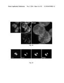 POLYPEPTIDES TARGETING GLYCOSYLATED MUC2 PROTEINS, METHODS OF SYNTHESIS,     THEIR NUCLEIC ACIDS AND USES THEREOF diagram and image