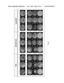 COMPOSITIONS AND METHODS OF TREATING OCULAR DISEASES diagram and image