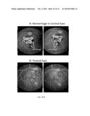 COMPOSITIONS AND METHODS OF TREATING OCULAR DISEASES diagram and image