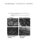 NEUTRALIZING PROLACTIN RECEPTOR ANTIBODY MAT3 AND ITS THERAPEUTIC USE diagram and image