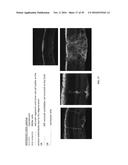 COMPOSITIONS AND METHODS FOR TREATING RETINAL DISEASES diagram and image