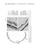 COMPOSITIONS AND METHODS FOR TREATING RETINAL DISEASES diagram and image