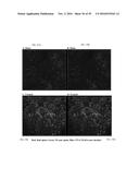 COMPOSITIONS AND METHODS FOR TREATING RETINAL DISEASES diagram and image