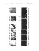 METHODS FOR DETECTING AND TREATING CANCER diagram and image