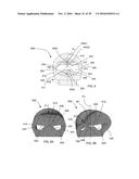 WIDE ACTIVATION ANGLE PINCH SENSOR diagram and image