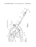 METHOD AND APPARATUS FOR REPAIRING A MITRAL VALVE diagram and image