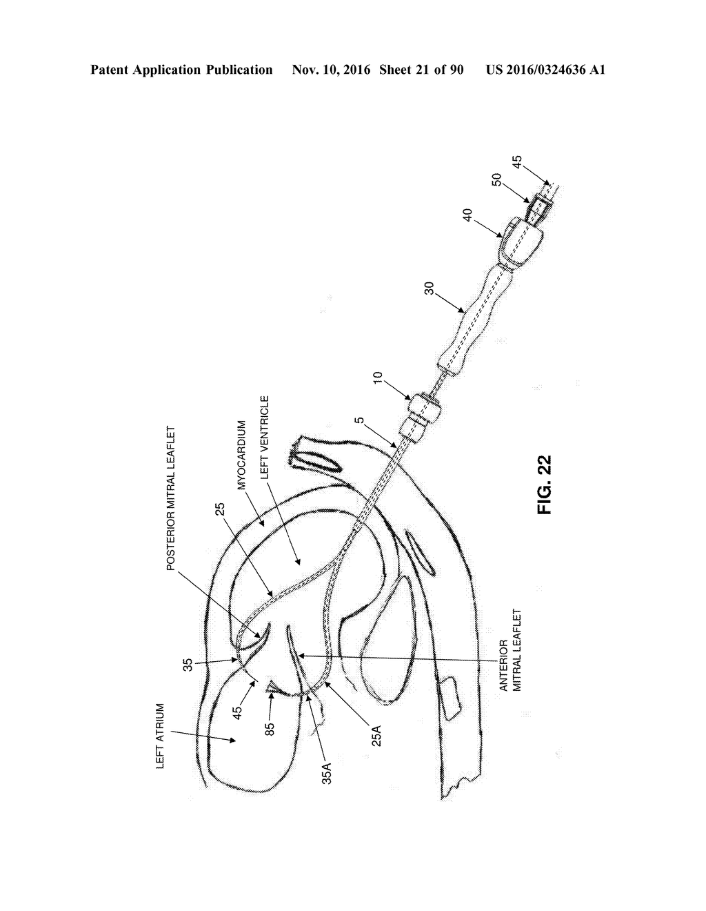 METHOD AND APPARATUS FOR REPAIRING A MITRAL VALVE - diagram, schematic, and image 22