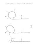 METHOD AND APPARATUS FOR REPAIRING A MITRAL VALVE diagram and image