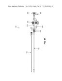 METHOD AND APPARATUS FOR REPAIRING A MITRAL VALVE diagram and image