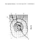 METHOD AND APPARATUS FOR REPAIRING A MITRAL VALVE diagram and image