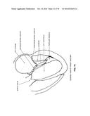 METHOD AND APPARATUS FOR REPAIRING A MITRAL VALVE diagram and image