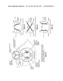 METHOD AND APPARATUS FOR REPAIRING A MITRAL VALVE diagram and image