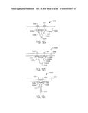 METHOD AND APPARATUS FOR CATHETER-BASED ANNULOPLASTY USING LOCAL     PLICATIONS diagram and image