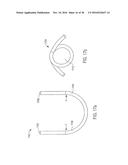 METHOD AND APPARATUS FOR CATHETER-BASED ANNULOPLASTY USING LOCAL     PLICATIONS diagram and image