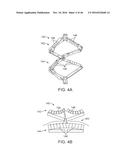 SYSTEM FOR MITRAL VALVE REPAIR AND REPLACEMENT diagram and image