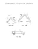 SYSTEM FOR MITRAL VALVE REPAIR AND REPLACEMENT diagram and image