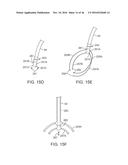 SYSTEM FOR MITRAL VALVE REPAIR AND REPLACEMENT diagram and image