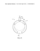 SYSTEM FOR MITRAL VALVE REPAIR AND REPLACEMENT diagram and image