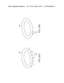 SYSTEM FOR MITRAL VALVE REPAIR AND REPLACEMENT diagram and image