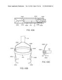 SYSTEM FOR MITRAL VALVE REPAIR AND REPLACEMENT diagram and image