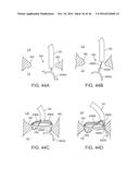 SYSTEM FOR MITRAL VALVE REPAIR AND REPLACEMENT diagram and image