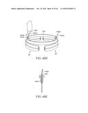 SYSTEM FOR MITRAL VALVE REPAIR AND REPLACEMENT diagram and image