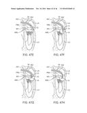 SYSTEM FOR MITRAL VALVE REPAIR AND REPLACEMENT diagram and image