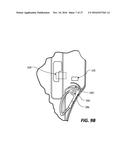 Holster Having a Removable Lockout Element diagram and image