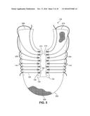 ARTICLE OF FOOTWEAR INCORPORATING A CURVED KNITTED LACING ELEMENT diagram and image