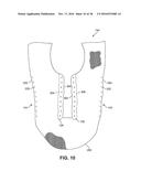 ARTICLE OF FOOTWEAR INCORPORATING A CURVED KNITTED LACING ELEMENT diagram and image