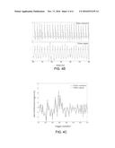 Contact-free physiological monitoring during simultaneous magnetic     resonance imaging diagram and image