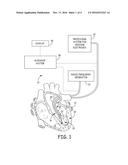 REAL-TIME FEEDBACK FOR ELECTRODE CONTACT DURING MAPPING diagram and image