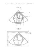 ULTRASONIC DIAGNOSTIC APPARATUS AND CONTROL METHOD diagram and image