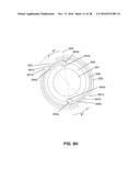 LOW PROFILE ELECTRODES FOR AN ANGIOPLASTY SHOCK WAVE CATHETER diagram and image