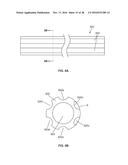 LOW PROFILE ELECTRODES FOR AN ANGIOPLASTY SHOCK WAVE CATHETER diagram and image