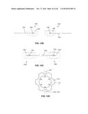 LOW PROFILE ELECTRODES FOR AN ANGIOPLASTY SHOCK WAVE CATHETER diagram and image