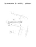 METHODS AND INSTRUMENTS FOR FORMING A POSTERIOR KNEE PORTAL AND FOR     INSERTING A CANNULA diagram and image