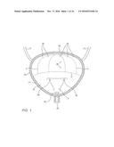 DEVICES AND METHODS FOR TRANSURETHRAL BLADDER PARTITIONING diagram and image