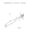 DEVICES AND METHODS FOR TRANSURETHRAL BLADDER PARTITIONING diagram and image