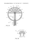 DEVICES AND METHODS FOR TRANSURETHRAL BLADDER PARTITIONING diagram and image