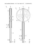 DEVICES AND METHODS FOR TRANSURETHRAL BLADDER PARTITIONING diagram and image