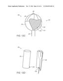DEVICES AND METHODS FOR TRANSURETHRAL BLADDER PARTITIONING diagram and image
