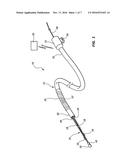 FEEDBACK SYSTEMS AND METHODS FOR RENAL DENERVATION UTILIZING BALLOON     CATHETER diagram and image