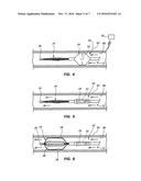 FEEDBACK SYSTEMS AND METHODS FOR RENAL DENERVATION UTILIZING BALLOON     CATHETER diagram and image