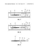 FEEDBACK SYSTEMS AND METHODS FOR RENAL DENERVATION UTILIZING BALLOON     CATHETER diagram and image